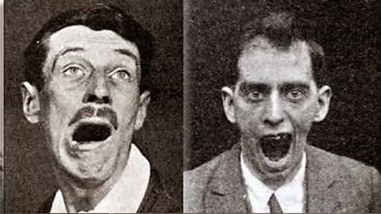 Tarihin en gizemli hastalığı: Yarım milyon insanı öldürdü, bir anda ortadan kayboldu